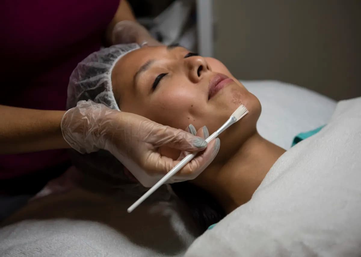 Chemical Peels at Dermatology and Skin Care Associates
