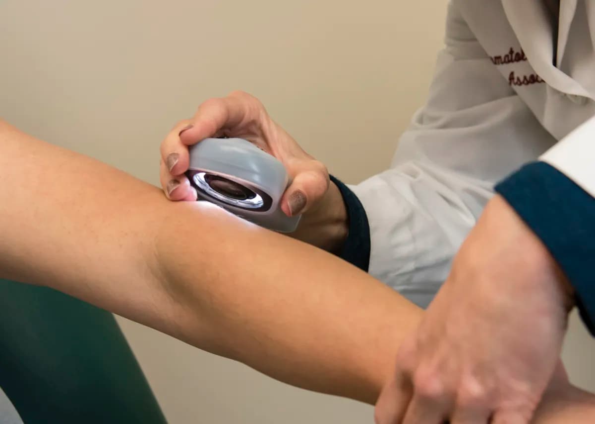 Dermoscopy skin cancer screening at Dermatology and Skin Care Associates in Wellesley, MA