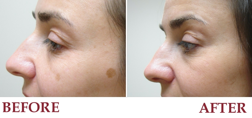 Home Dermatology And Skin Care Associates
